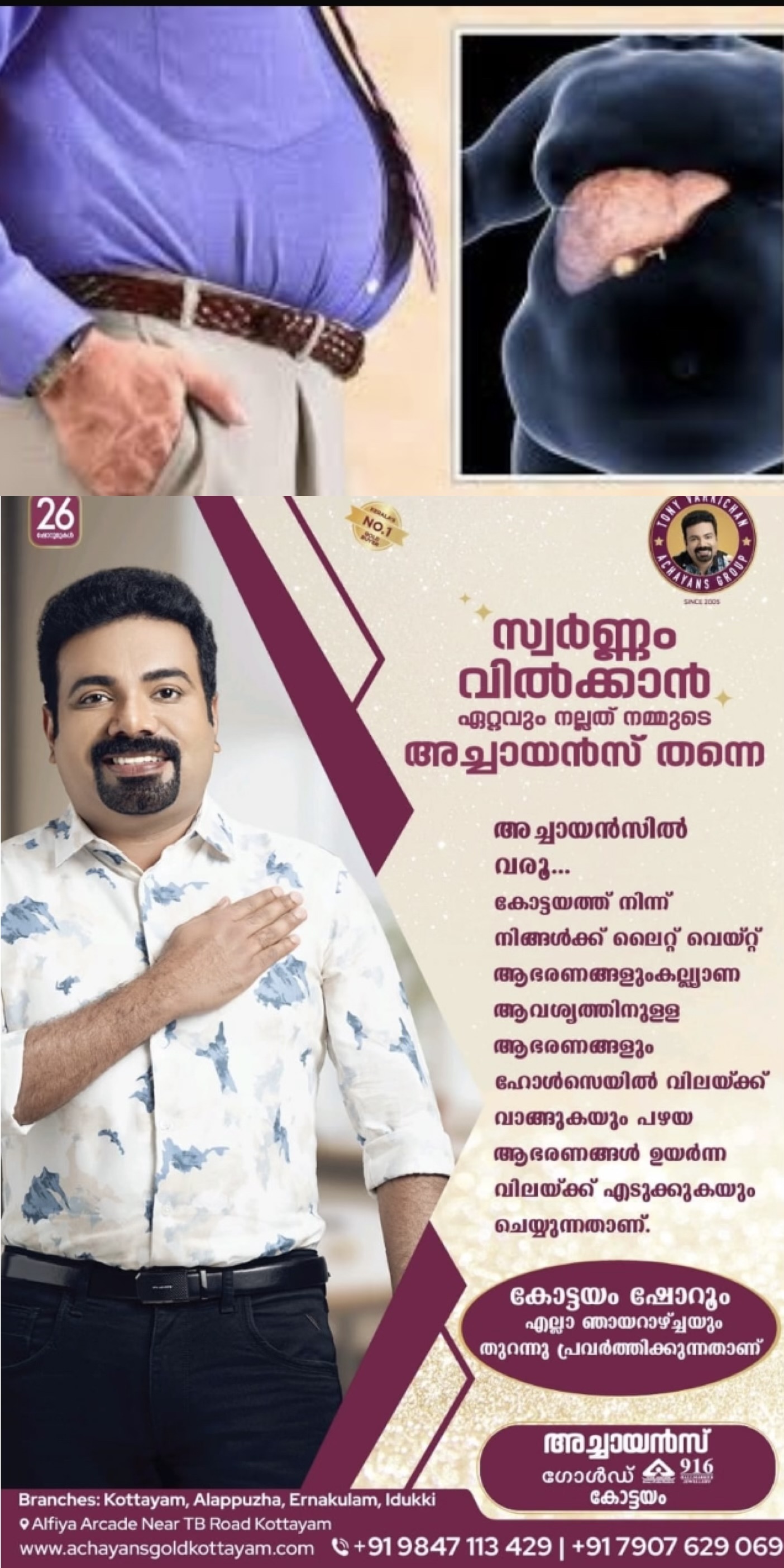 ഫാറ്റിലിവര്‍ രോഗത്തെ തടയാന്‍  ഈ ഡയറ്റും വ്യായാമവും ചെയ്തു നോക്കൂ!