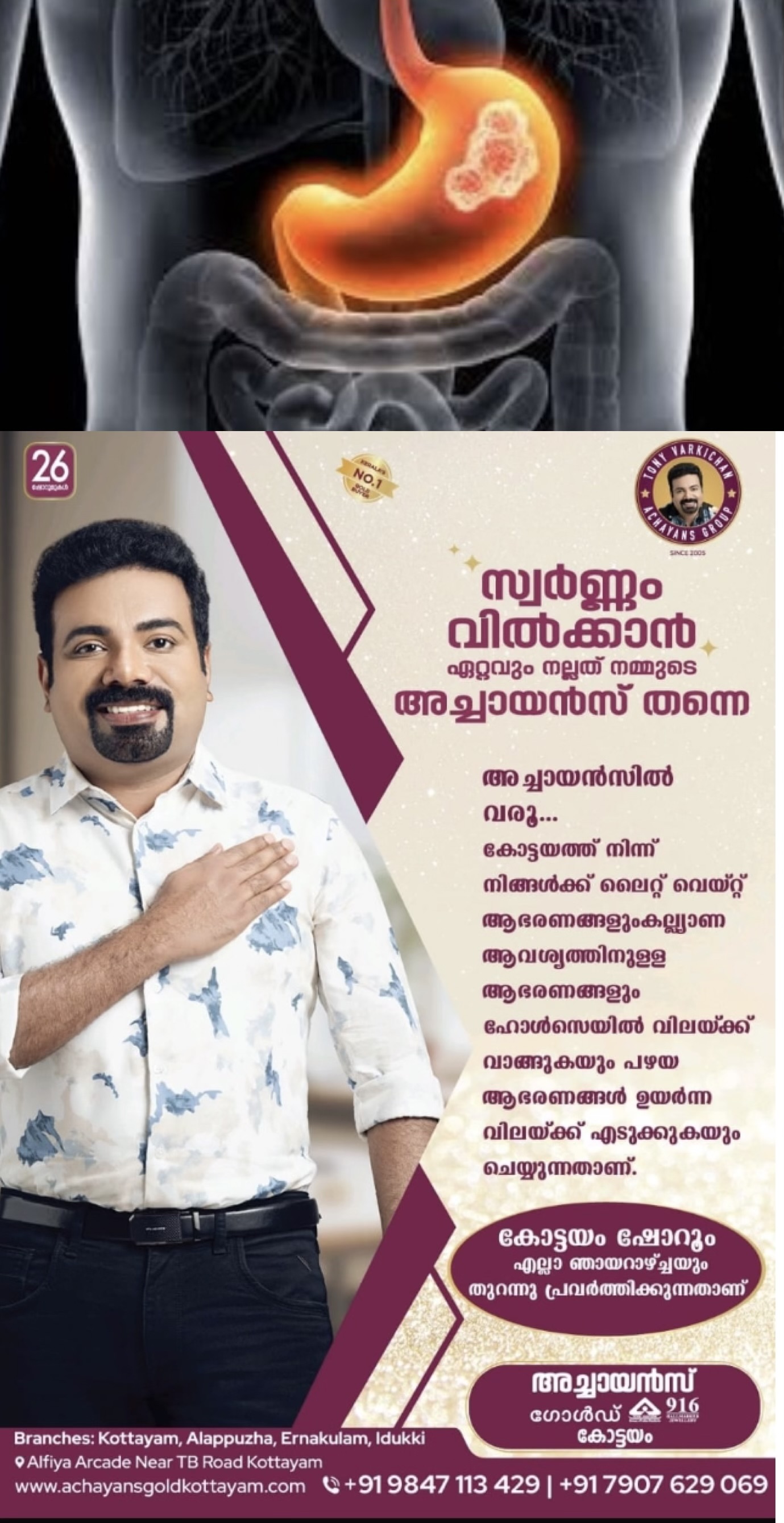 ഗ്യാസ്ട്രിക് കാന്‍സര്‍ എങ്ങനെ തിരിച്ചറിയാം ?