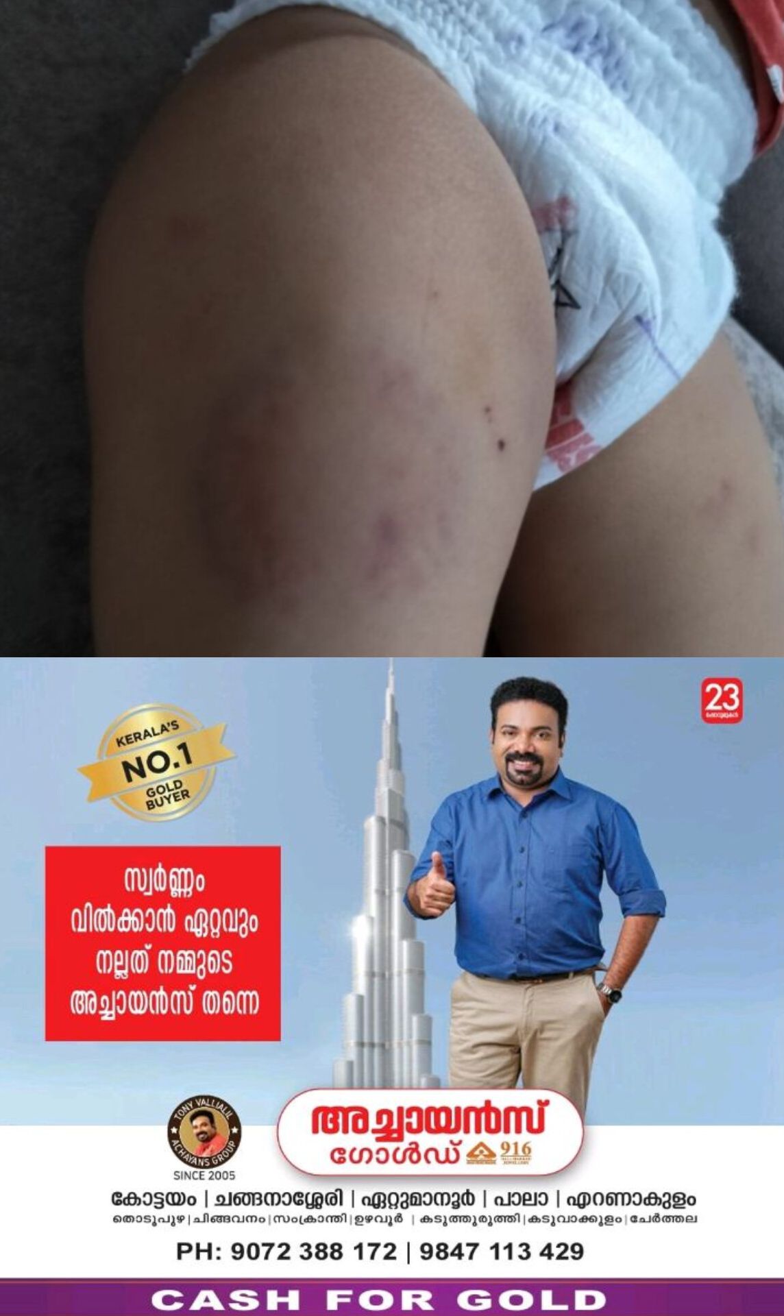 *15 മാസം പ്രായമുള്ള പെണ്‍ കുഞ്ഞിനോട്‌ ഡേ കെയർ ജീവനക്കാരിയുടെ സമാനതകളില്ലാത്ത ക്രൂരത*