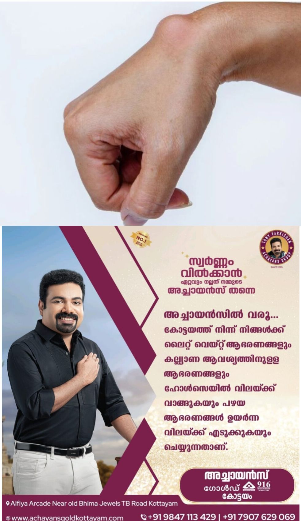 *നിങ്ങളുടെ ശരീരത്തില്‍ വേദനയില്ലാത്ത മുഴകളോ വീക്കങ്ങളോ ഉണ്ടോ? അറിയാം സാര്‍കോമ കാന്‍സറിനെക്കുറിച്ച്*