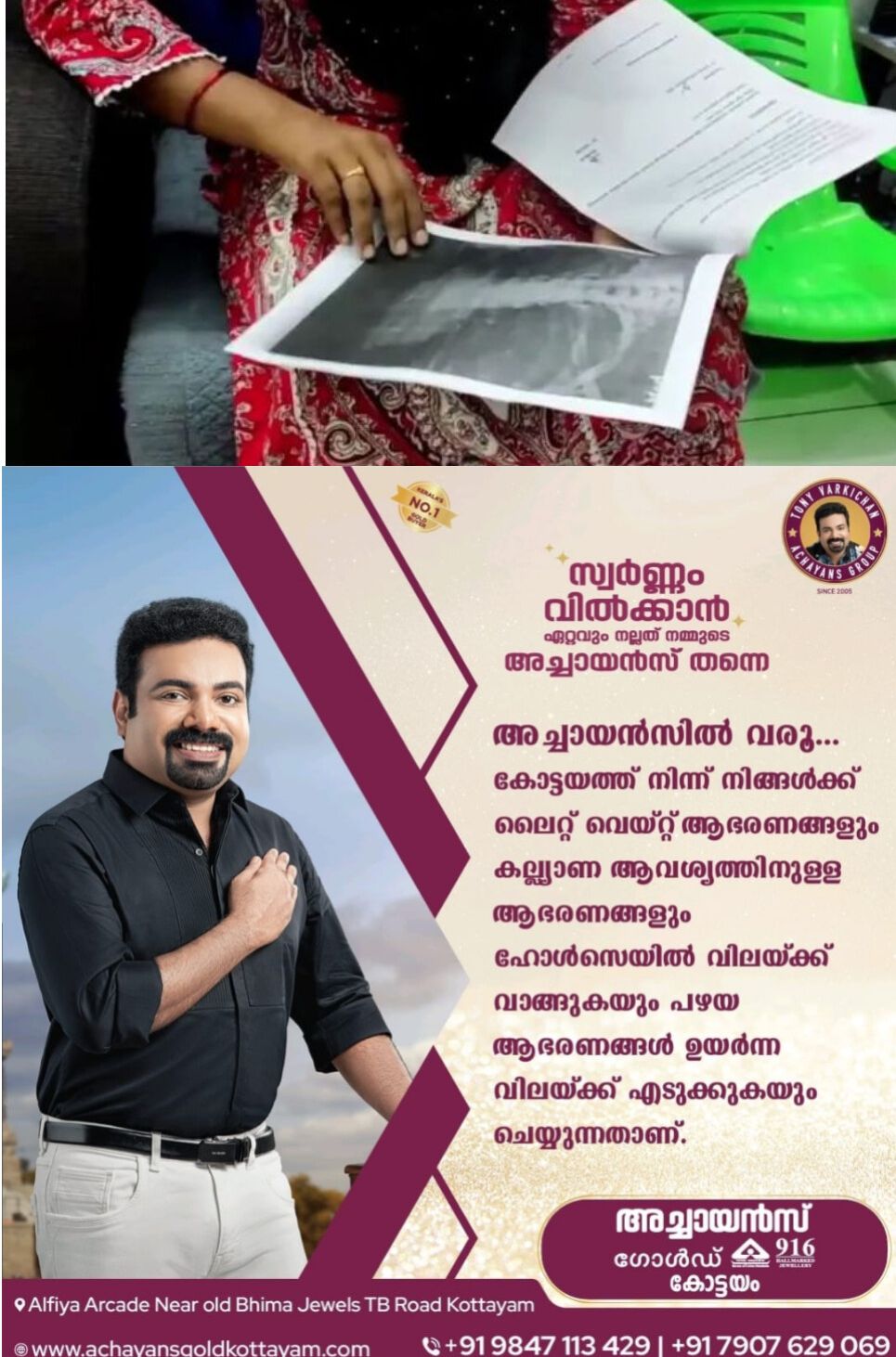 *നെഞ്ചിൽ കുടുങ്ങിയ ട്യൂബ് എടുക്കാൻ മറന്നു, ജനറല്‍ ആശുപത്രിയില്‍ ചികിത്സ പിഴവ് സമ്മതിച്ച്‌ ‍ഡോക്ടര്‍*