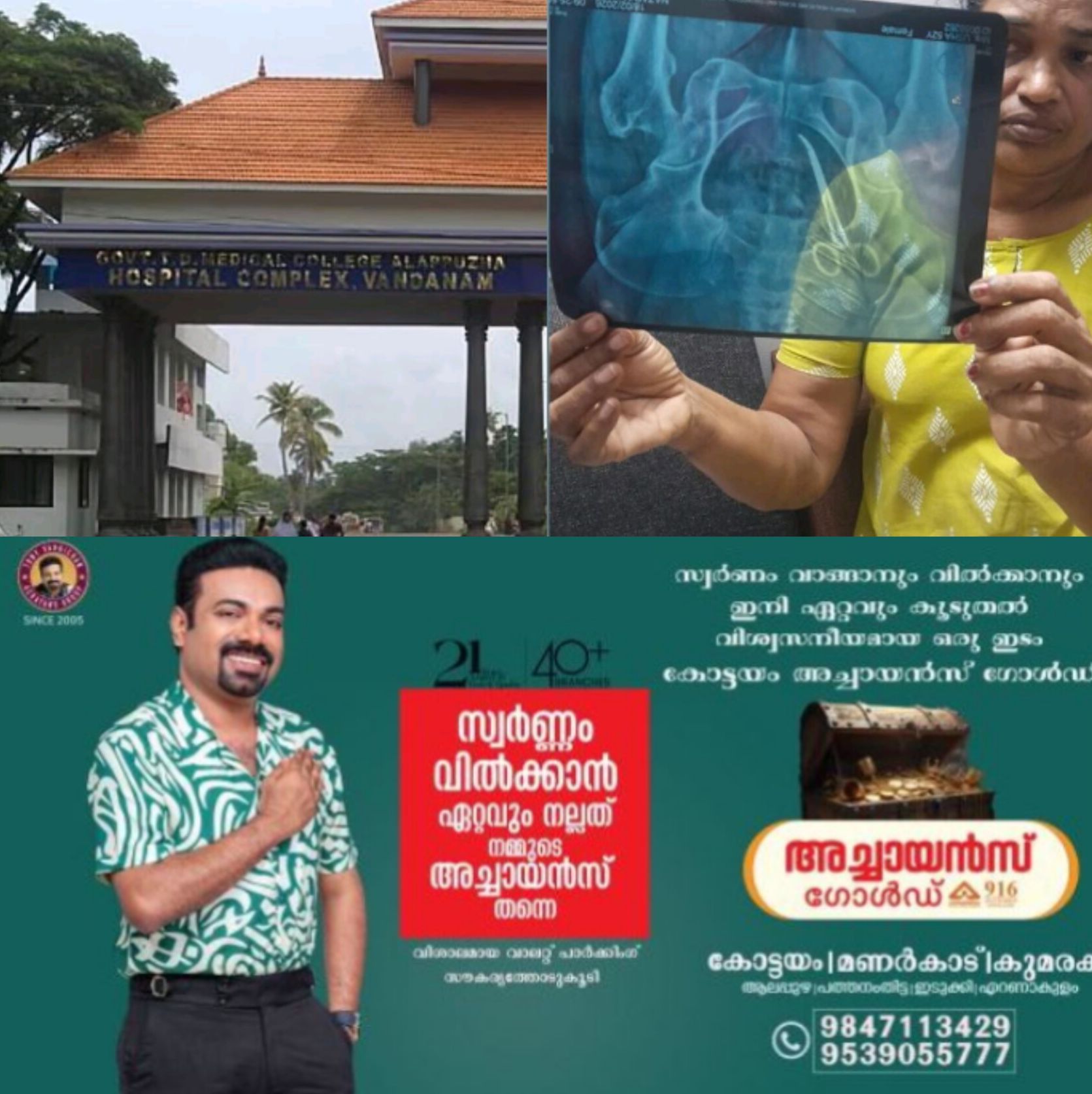 *ആലപ്പുഴ മെഡിക്കൽ കോളേജിൽ ശസ്ത്രക്രിയ പിഴവ്:  ആശുപത്രി വാർത്താസമ്മേളനത്തിലേക്ക് തള്ളിക്കയറി യൂത്ത് കോൺഗ്രസ് പ്രതിഷേധം*