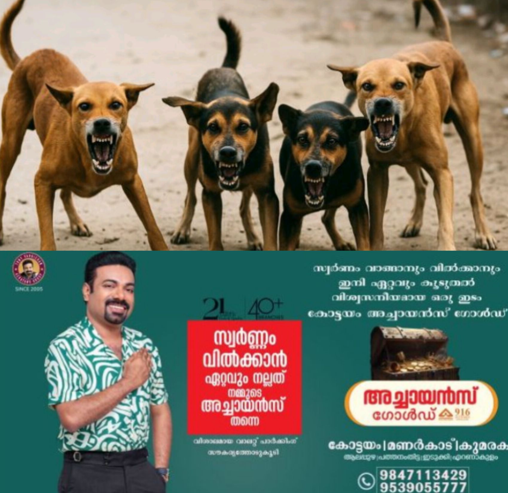 *നായയുടെ കടിയേറ്റ് മൂന്നുവയസുകാരന്റെ ചെറുവിരൽ ഭാഗികമായി നഷ്ടപ്പെട്ടു*