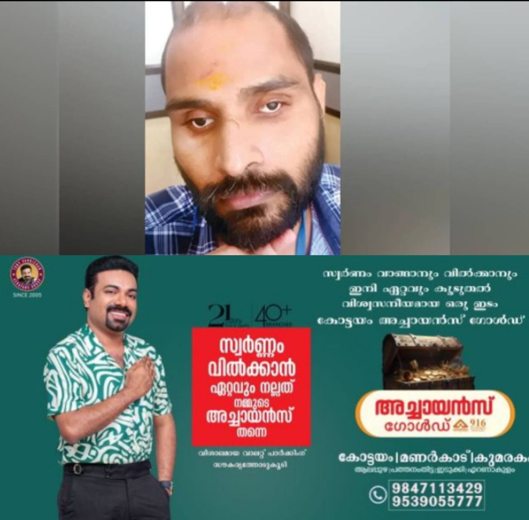*ചികിത്സാപിഴവ് വിവാദം: സനൂപിന് താല്&zwj;ക്കാലിക കൃത്രിമക്കണ്ണുകള്&zwj;; പ്രത്യേക പരിശീലനത്തോടെ പുതിയ തുടക്കം*