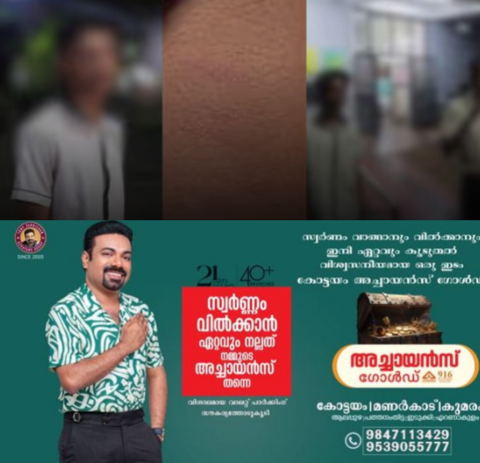 *കോഴിക്കോട് മടവൂർ ഹയർ സെക്കന്&zwj;ഡറി സ്കൂളിൽ എട്ടാം ക്ലാസുകാരന് ക്രൂര മർദ്ദനം,15 വിദ്യാർത്ഥികൾക്കെതിരെ പരാതി*